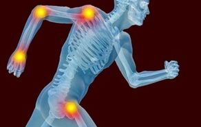 Les raisons du développement des arthrons et de l'arthrose