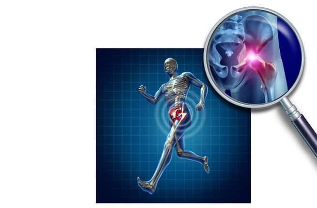 Douleur lorsque vous courez dans l'articulation de la hanche